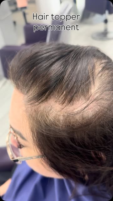 This is a permanent hair topper that requires monthly maintenance. It breathes, it behaves like your