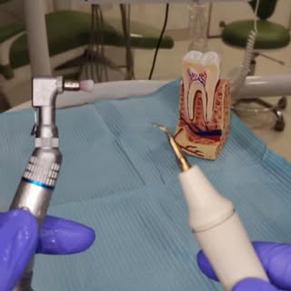 🦷 When patients visit the dentist after months… or YEARS

6️⃣ After 6 months: Just a bit of tartar 