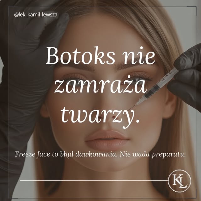 Większość osób nie boi się samego botoksu.
Boi się efektu, który widziała u innych.

„Maska”.
Brak m