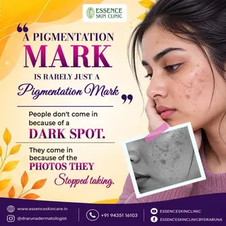 A pigmentation mark is rarely “just a pigmentation mark.”

Sometimes, it’s the reason you stopped cl
