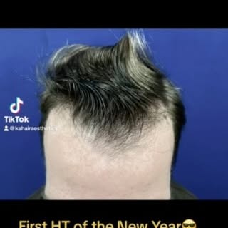 First HT of the New Year 2023🥂😎 We look forward to helping you reach your hair goals!!!
#hairtrans