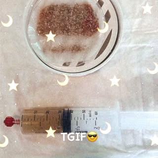 TGIF🥸 #hairtansplant #neograft #atlantahair #prp #hairrestorationsurgery #kahairaesthetics #hairlin