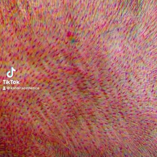 FYI…. Crown swirl pattern is important as well as graft directional placement is IMPORTANT…. Remembe