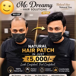 Explore our stylish wigs and patches for a natural look. Perfect for enhancing your hairstyle effort