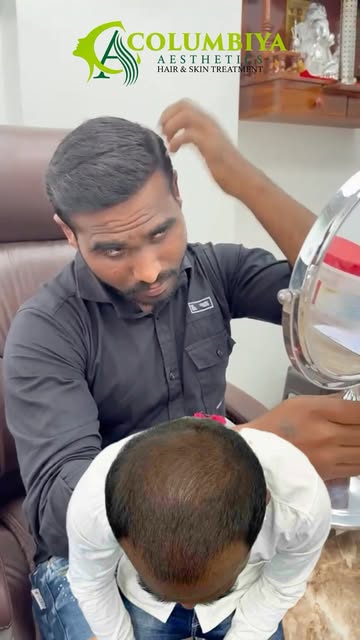 He saw his friend’s hair transplant results at Columbiya Aesthetics—and that’s what brought him to u