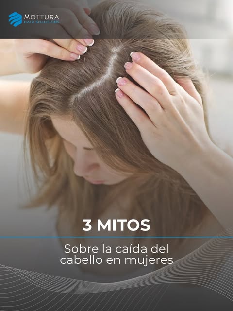 ¿La caída siempre es por estrés? ¿La alopecia es cosa de hombres? ¿Hay que esperar a perder mucho ca