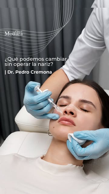 ¿Se puede mejorar la forma de la nariz sin cirugía? 👃

▶️ En este reel, el Dr. Pedro Cremona nos cu