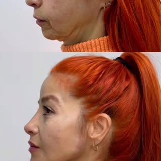 Pessoal, olhem esse antes e depois 🤩🤩

Sempre enfatizo a importância de reposicionar estruturas fa