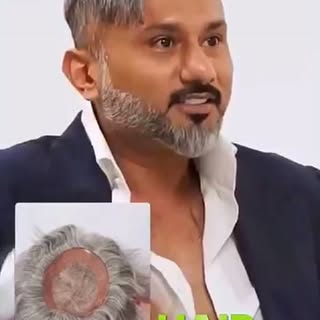 Confidence Wapas Lene Ka Waqt Aa Gaya Hai! 😎

Kya aap bhi hair fall ya ganjepan se pareshan hain? A