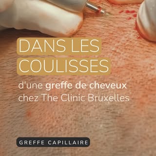 Dans les coulisses d'une greffe 🎬⁠
⁠
On vous ouvre les portes du bloc, à Waterloo. De la préparatio