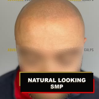 Hair loss can feel overwhelming — but you’re not alone, and there is a solution 💬💙

If you’re stru