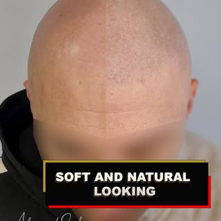 BEFORE AND AFTER: Every client is different, and that’s exactly how I approach every treatment.
For 