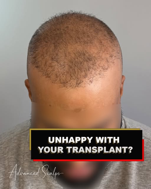 From consultation to first-session results 👊
A look behind the scenes of this client’s first Scalp 