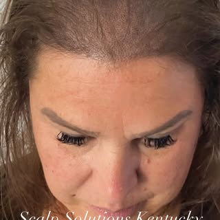 Ladies & Gentlemen the appearance of hair thinning or hair loss doesn’t have to be with SMP. Contact