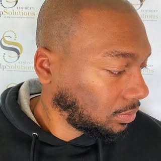 When You Look Your Best & Feel Your Best, You Do Your Best! Scalp Micropigmentation can help you ach