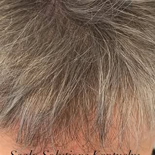 SPRING Is Here! Feel like you need a boost? It doesn’t matter if you have a little hairloss or a lot