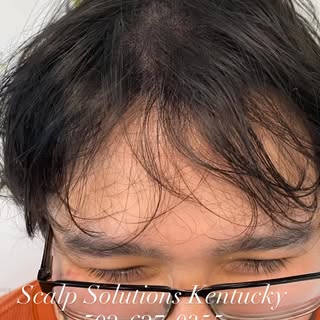 A Little David Copperfield Density SMP! You can make hair loss disappear! Call me at 502-627-0355 or