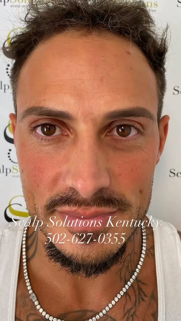 Confidence Can Change Your Life! Let me show you how. Call 502-627-0355 today. www.scalpsolutionsken