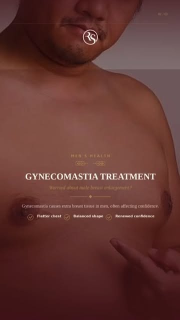 Gynecomastia can affect more than just your chest—it can impact your confidence too.

Treatment can 