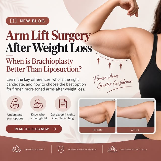 Loose skin after major weight loss? An Arm Lift may be the better option when liposuction alone isn’