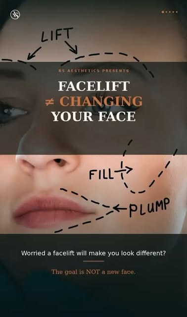 A facelift isn’t about changing who you are—it’s about looking like a refreshed version of yourself.