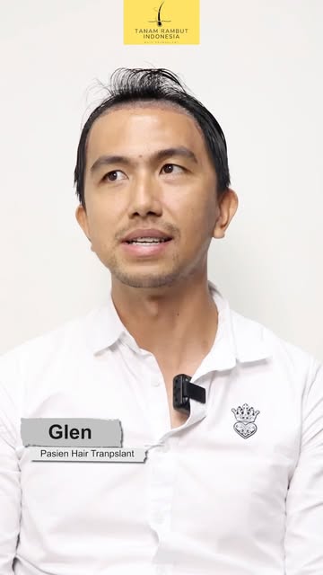 Masih ragu untuk menjalani Hair Transplant? Simak langsung pengalaman Pak Glenn setelah menjalani tr