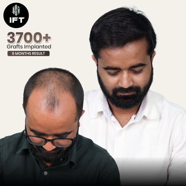 Diffuse Thinning ho rahi hai ?
Shayad ab sirf hairstyle change karne ka time nahi hai.

A well-plann