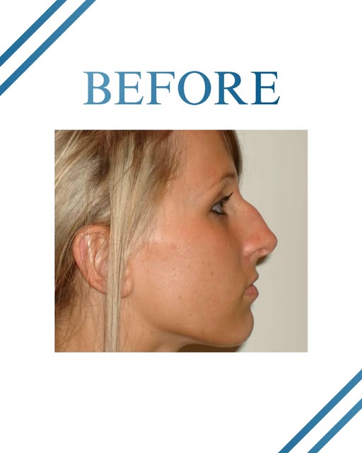 Results driven with care ✨ #beforeandafter #results #aesthetics #cosmetics #doctor