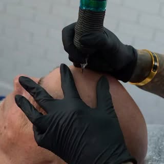 Tony talks pain! I promise you the most painful part of your appt is dealing with me for 2 hours 🤣
