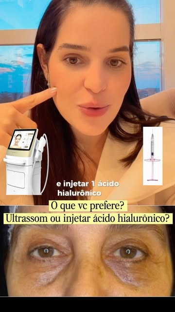 O que vc prefere? Ultrassom coreano ou injetar ácido hialurônico? Me fala aqui nos comentários 👇🏻