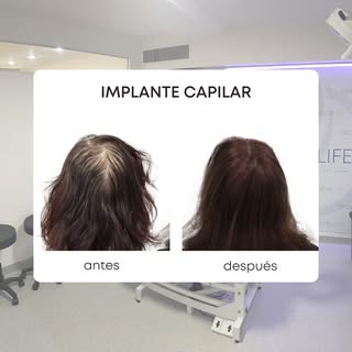 La belleza es más que apariencia: es confianza, seguridad y autoestima. ✨ Recuperalas en Tricolife. 