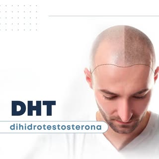 La DHT es una de las principales responsables de la caída del pelo. ¿Sabés cómo actúa? Te lo explica