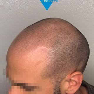 Da un prima che non lo rappresentava più, a un dopo che gli ha restituito sicurezza e naturalezza. �