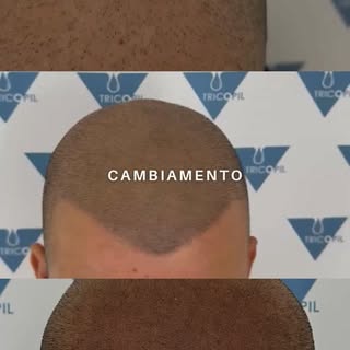 Il tuo cambiamento inizia da qui✅

📲3714153578
📍Milano