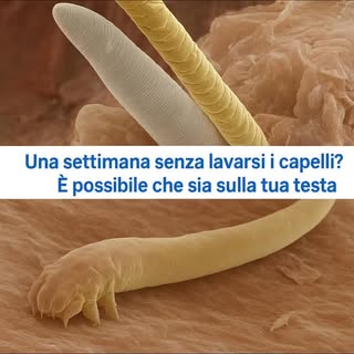 ACARI SULLA TUA TESTA? 
Sì, ma non spaventarti.
Il Demodex folliculorum vive nel follicolo pilifero 