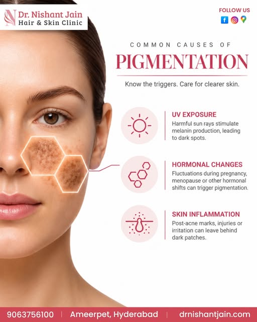 ✨ Common Causes of Pigmentation – Know the Triggers, Care for Clearer Skin! ✨

Struggling with dark 