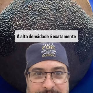 Você sabe o que é a ALTA DENSIDADE no Transplante Capilar FUE?
Dr. Gustavo Mello
CIRURGIA PLÁSTICA E