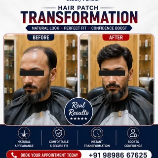 ✨ Another Amazing Hair Patch Transformation ✨

A small change in appearance can make a big differenc