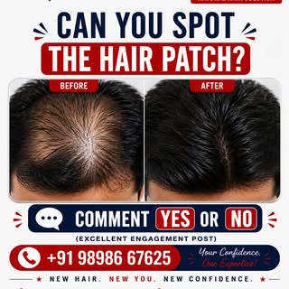 👀 Can You Spot The Hair Patch?

Take a close look at the image and tell us what you think!

Is the 