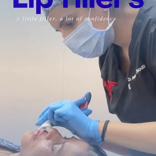 Lip filler isn’t about making every pair of lips look bigger. It’s about enhancing your natural shap