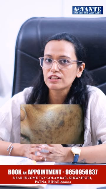 “Struggling with pigmentation? Get clear, even-toned and radiant skin with our advanced pigmentation