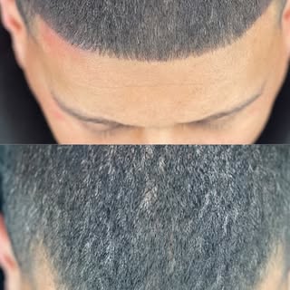 He said it !! LOOK AT THAT S**t !
 #xposedsmp #xposedcosmetics #smp #hairtattoo #tattoohair #microbl