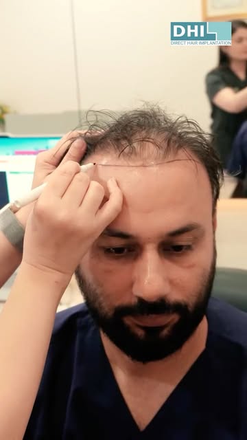 Your hair restoration journey, guided by experts at every step. 💙

Experience a smooth and comforta