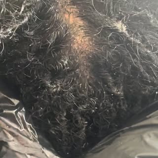Scalp Detox, and micro loc retie. I know you all can see the little white bulbs throughout her locs.