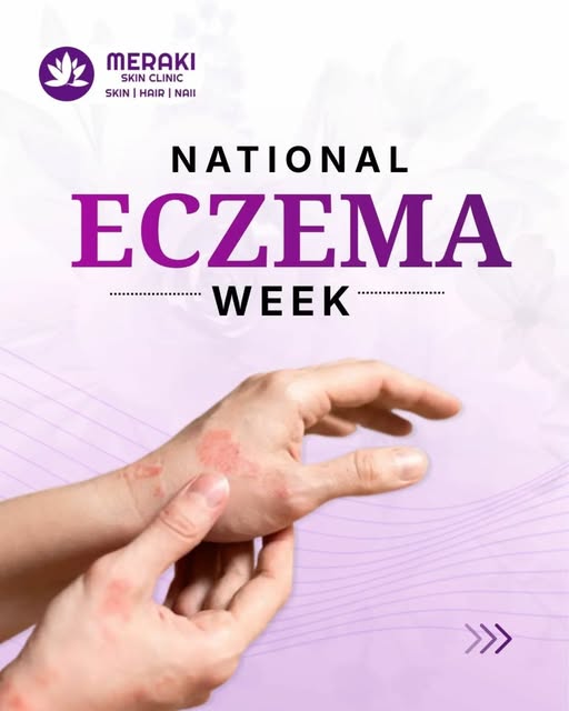 National Eczema Week 💜
Let’s raise awareness about eczema, understand your skin better, and take th