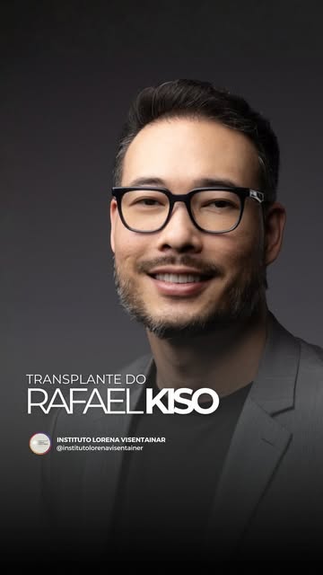 O Rafael Kiso realizou o transplante capilar comigo em janeiro do ano passado, aqui no @institutolor