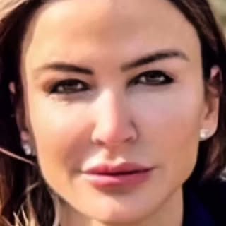 ✨Endoscopic Forehead Lift, Upper Blepharoplasty.
✨Post-Op 2nd year.

Op. Date: 03.03.23
Pre-op: 03.0