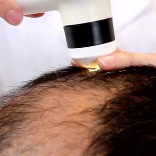 ¿Notas caída excesiva del cabello? 🧑‍⚕️❌💇‍♀️ ¿Pérdida de densidad o zonas con menor cobertura? 🕵️