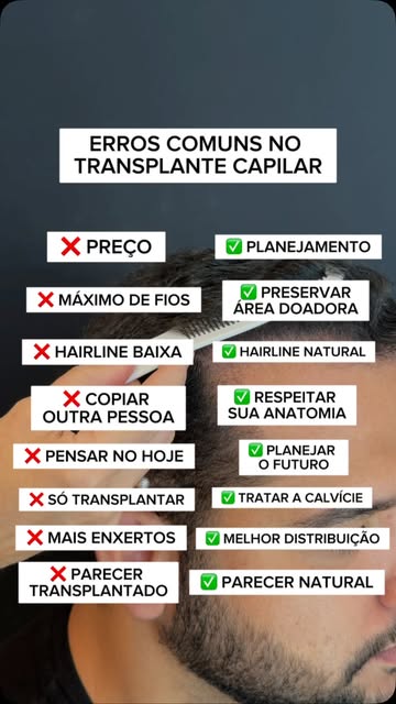O maior erro em um transplante capilar pode acontecer antes mesmo da cirurgia.

Quando a decisão com