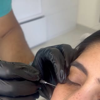 A Botox before and after to make our day 😍

Book a consult to dicuss what YOUR goals are!

🩺MD
⚕️P